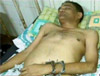 Chhatisgarh environmentalist handcuffed to hospital bed