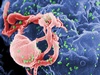 Bone marrow transplant busts HIV in two patients