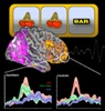 ‘Almost winning’: how near misses for gamblers fire off a ‘win’ response in the brain