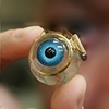 Blind woman fitted with “bionic eye” sees again after five years