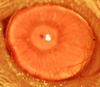 Researchers regrow human corneas; could reverse blindness