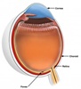 A map for eye disease