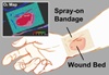 ‘Smart’ bandage emits phosphorescent glow for healing below