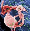 Danish researchers activate hidden HIV cells in major step towards a possible cure