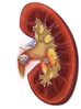 Global warming associated with higher incidence of kidney stones