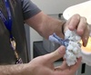 3-D-printed kidney helps doctors save woman's organ during complicated tumor removal