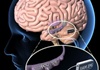 Researchers to develop 'brain prosthesis' to help brain-injured patients recover memory