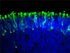 Researchers use human stem cells to create light-sensitive retina in a dish