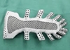 Cancer patient receives 3D printed titanium sternum and rib implant