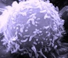 Stress and cancer link: stress gene enables cancer’s spread