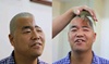 Chinese docs use 3D printer to restore man’s shattered skull