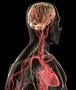 Researchers find genetic link between heart disease and brain aneurysms