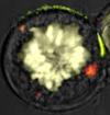 Cancer-killing cells caught on film in greater 3D detail than before