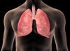 Scientists uncover how lung cancer spreads