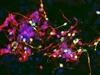 Researchers find key to making neurons from stem cells